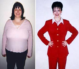 Rachel - Before and After